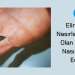 Elinizdeki Nasırlara Neden Olan Nedir ve Nasıl Tedavi Edilir? 2 Elinizdeki Nasırlara Neden Olan Nedir ve Nasıl Tedavi Edilir?